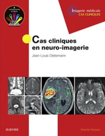 Cas cliniques en neuro-imagerie【電子書籍】[ Jean-Louis Dietemann ]