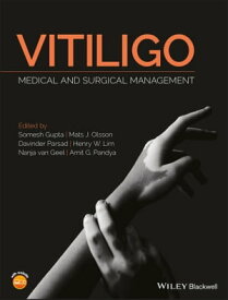 Vitiligo Medical and Surgical Management【電子書籍】