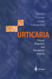 Urticaria Clinical, Diagnostic and Therapeutic Aspects【電子書籍】