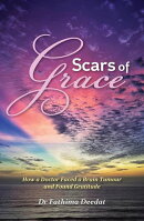 Scars of Grace