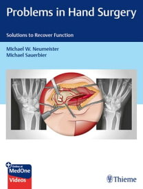 Problems in Hand Surgery Solutions to Recover Function【電子書籍】