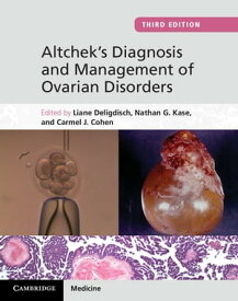 Altchek's Diagnosis and Management of Ovarian Disorders【電子書籍】