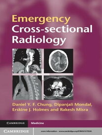 Emergency Cross-sectional Radiology【電子書籍】[ Dipanjali Mondal ]
