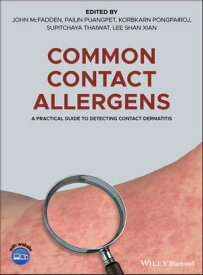 Common Contact Allergens A Practical Guide to Detecting Contact Dermatitis【電子書籍】