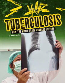 Tuberculosis How the White Death Changed History【電子書籍】[ Mark K. Lewis ]