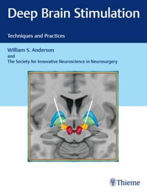 Deep Brain Stimulation Techniques and Practices【電子書籍】[ William S. Anderson ]