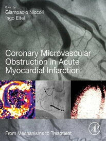 Coronary Microvascular Obstruction in Acute Myocardial Infarction From Mechanisms to Treatment【電子書籍】