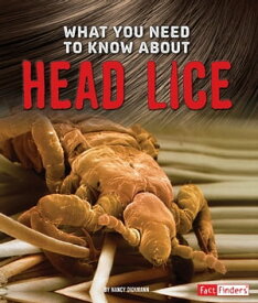 What You Need to Know about Head Lice【電子書籍】[ Nancy Dickmann ]