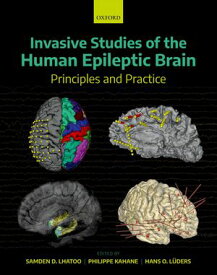 Invasive Studies of the Human Epileptic Brain Principles and Practice【電子書籍】