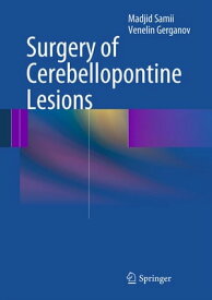 Surgery of Cerebellopontine Lesions【電子書籍】[ Madjid Samii ]
