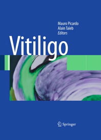 Vitiligo【電子書籍】