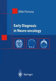 Early Diagnosis in Neuro-oncology【電子書籍】[ Aldo Fortuna ]