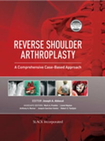 Reverse Shoulder Arthroplasty A Comprehensive Case-Based Approach【電子書籍】