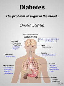 Diabetes The Problem Of Sugar In The Blood...【電子書籍】[ Owen Jones ]