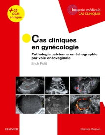 Cas cliniques en imagerie : gyn?cologie Pathologie pelvienne en ?chographie par voie endovaginale【電子書籍】[ Erick Petit ]