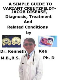 A Simple Guide to Variant Creutzfeldt-Jakob Disease, Diagnosis, Treatment and Related Conditions【電子書籍】[ Kenneth Kee ]
