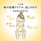 ヘパソフト薬用顔ローション100g【ヘパソフト】