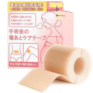 y畆ȐďCzՃPAe[v鉤؊Je[vPChe[vp̏e[vƃPAe[vVRe[vwJbg^Cvx(4cmx150cm)