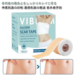 e[v ƃPApVRWFV[g hB PCh ƃPAe[v p 4cm×150cm 鉤؊J ^gD[ B F ʋC tatoo Ղ ƃPAe[v ڗȂ