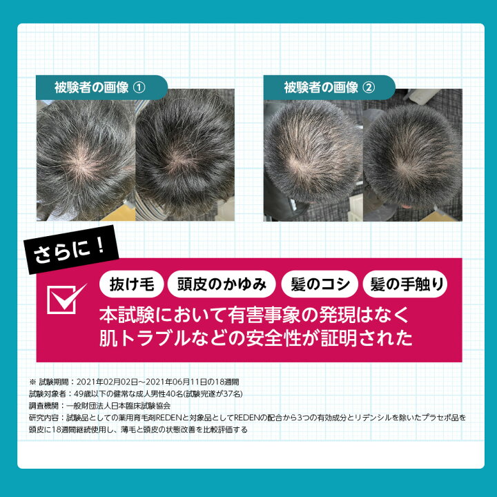 楽天市場】【公式】REDEN ヘアケアセット 育毛剤 薬用シャンプー 各2本 