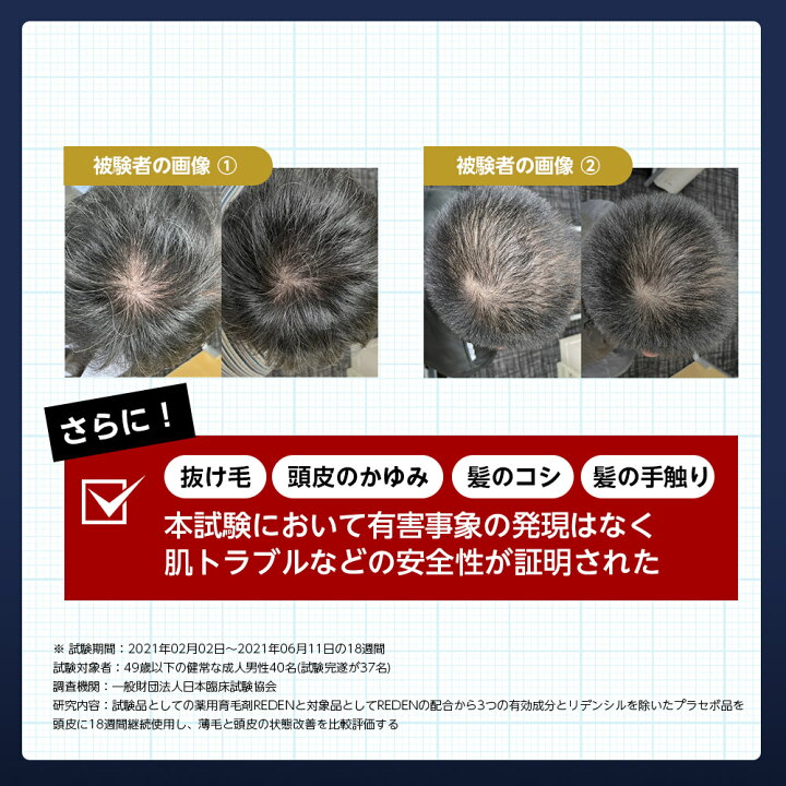 楽天市場】【臨床試験済】【公式】 REDEN 薬用育毛剤 3本セット リデン  