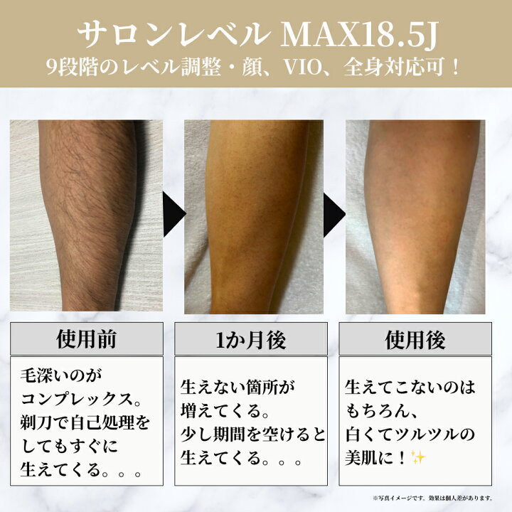 脱毛の効果