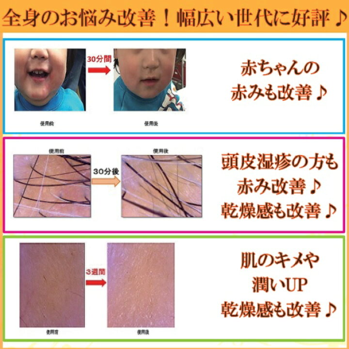 楽天市場 ２本set 送料無料 人気 おすすめno 1高濃度炭酸100 全身 顔 髪 ツヤ スプレー ミスト 大容量 保湿 頭皮 乾燥肌 敏感肌 炭酸 化粧水 メンズ うるおい 乾燥性敏感肌 肌弱い スキンケア かゆみ Uvケア 導入液 スカルプ さっぱり 白ボトル 赤リボン 赤ちゃん