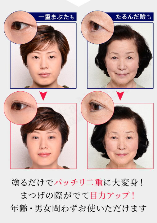 楽天市場 後払い可 選べるおまけ ルドゥーブル 8ml 送料無料 ル ドゥーブル 二重まぶた 化粧品 ル ドゥーブル 二重瞼 二重 自然 瞼 目蓋 アイプチ 一重 奥二重 三重 二重 矯正 二重 クセ付け ウォータープルーフ Ledouble アチーブ Nkp Bnm ふたえ りかの良品
