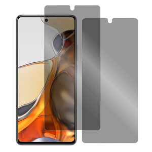 【安心の2枚入り】LOOF Xiaomi 15T 15 14 14T Ultra 14 13 Pro + 13T 12T Pro POCO M7 F7 Ultra X7 F6 Pro Redmi 14C 12 5G 12C Note 11 Pro 5G 10T 11T Pro Mi 11 Lite 5G Note 10 Pro 9T 強化ソフトフィルム Note 9S ブルーライトカット マッ