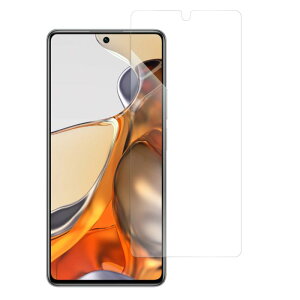 LOOFXiaomi 15T 15 14 14T Ultra 14 13 Pro + 13T 12T Pro POCO M7 Pro F7 Ultra X7 F6 Pro Redmi 14C 12 5G 12C Note 11 Pro 5G 10T 11T Pro Mi 11 Lite 5G Note 10 Pro 9T \tgtB ˖h~ Note 9S یtB wh~ Od