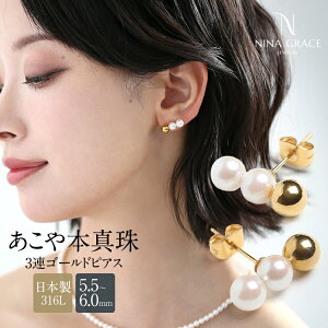 ^ sAX 5.5-6.0mm AM[ T[WJXeX 316L AR^  AR p[ ^ 3A gvp[ { ANZT[ fB[X S[h  w 