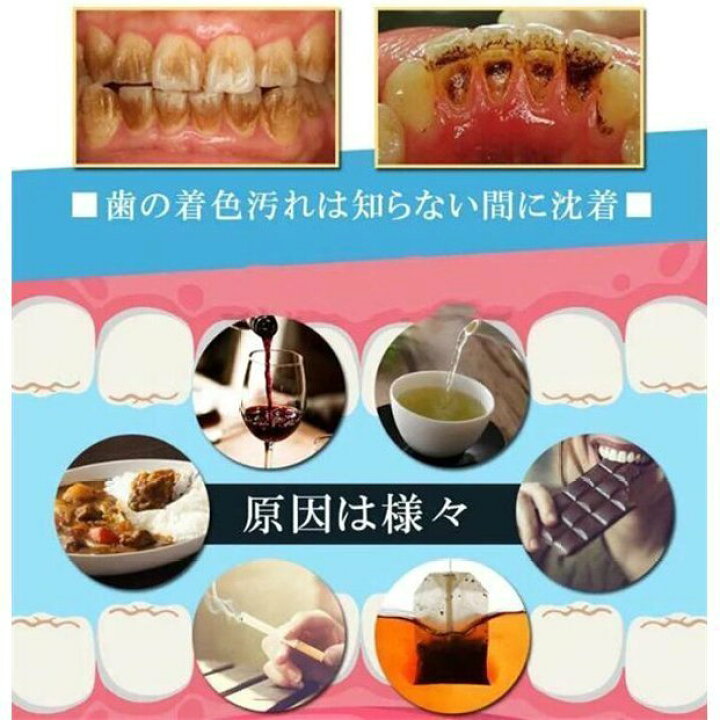 楽天市場】【送料無料】 口腔洗浄器 超音波スケーラー口臭予防 歯周病予防 IPX6防水 口腔洗浄器歯用ツール 超音波デンタルクリーナー 歯石取り器具 口腔洗浄器 歯石取りスクレバー : ROUND-ERA 楽天市場】【送料無料】 口腔洗浄器 超音波スケーラー口臭予防 歯周病予防 IPX6防水 口腔洗浄器歯用ツール 超音波デンタルクリーナー 歯石取り器具 口腔洗浄器 歯石取りスクレバー : ROUND-ERA