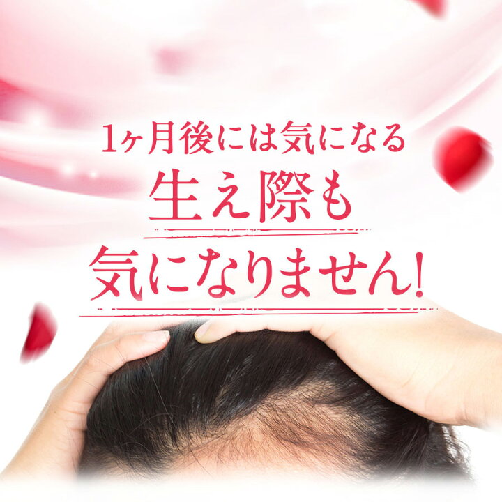 楽天市場】【1個あたり5,060円】南野陽子さん愛用！ バランローズ KURO  