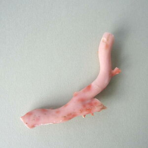 sN iK[lj X } p[c ANZT[ޗ  ΃TS X荥 җ a j   3̒a Mtg v[g 35N XEl