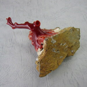 {EmYԎX }p[c  y u  w΃TSx X荥 җ a j   3̒a Mtg v[g 35N XEl