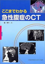 楽天市場】ここまでわかる急性腹症のct 第2版の通販