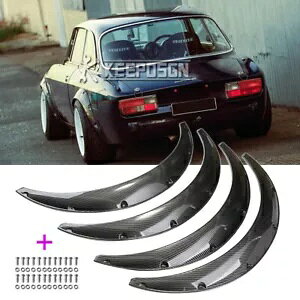 At@I 2000 GTV WA tF_[ tA Ch{fB A[` }bhK[h J[{bNp For Alfa Romeo 2000 GTV Giulia Fender Flares Widebody Arch Mudguard CARBON Look