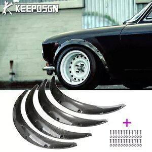 At@I 2000 GTV 150 GT GTA tF_[ tA Ch{fB A[` }bhK[h J[{p For Alfa Romeo 2000 GTV 150 GT GTA Fender Flares Widebody Arch Mudguard CARBON