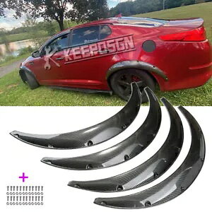 KIA IveB} SXL LX tF_[tAzC[A[`Ch{fB}bhK[hJ[{bN 35" For KIA Optima SXL LX Fender Flares Wheel Arch Widebody Mudguard CARBON Look 35"