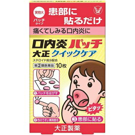 ★【指定第2類医薬品】口内炎パッチ大正クイックケア