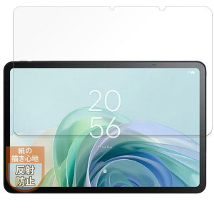 MotoMoto �t�B���� TCL TAB 11 Gen 2 (9465X5) �p ���ɏ����Ă���悤�ȕ`���S�n �ی�t�B���� ���˒ጸ ���{��