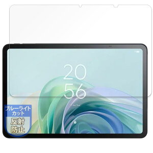 MotoMoto �t�B���� TCL TAB 11 Gen 2 (9465X5) �p �u���[���C�g�J�b�g �ی�t�B���� ���˒ጸ ���{��