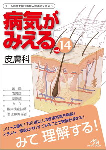 aC݂volD14 畆 ^ fBbNfBA