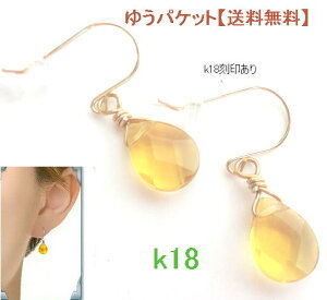 F΃sAXk18@CG[Tt@CA 18 tbN K18 fB[X Lb`L hbvJbg ꗱWG[sAX 䂤pPbgyz