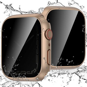 yzy`h~z Singiuzoo AbvEHb`p h Jo[ 44mm Apple Watch P[X ̂h~ یtB ȒP ϏՌ y vCoV[ی iWatch Series 6 5 4 SE Ή [Y