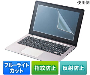 TTvC 15.6^ChΉ@u[CgJbgtیw䔽˖h~tB 1 LCD-BCNG156W
