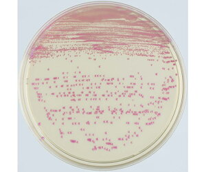 xNgEfBbL\ BD BBLiTMj CHROMagariTMj MRSA II V|n 100 1(1{×100) 252354