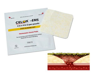 Medtrade Products ZbNX EMS ~K[[ 8×8 1܁i4j 1(4)