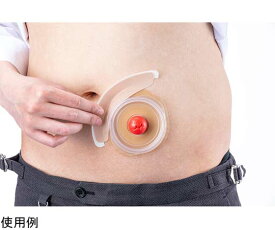 アルケア メクレガード?テープ（ストーマ用装具固定テープ） 15枚入 1箱(15枚入) 21011 ポスト投函