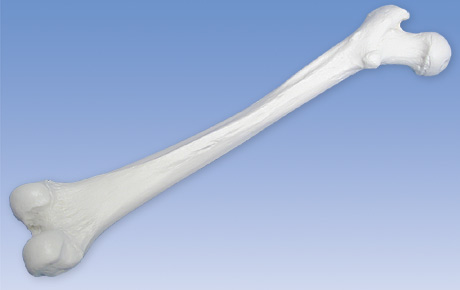 3B社 大腿骨模型 A35 1L 大腿骨モデル 人体模型